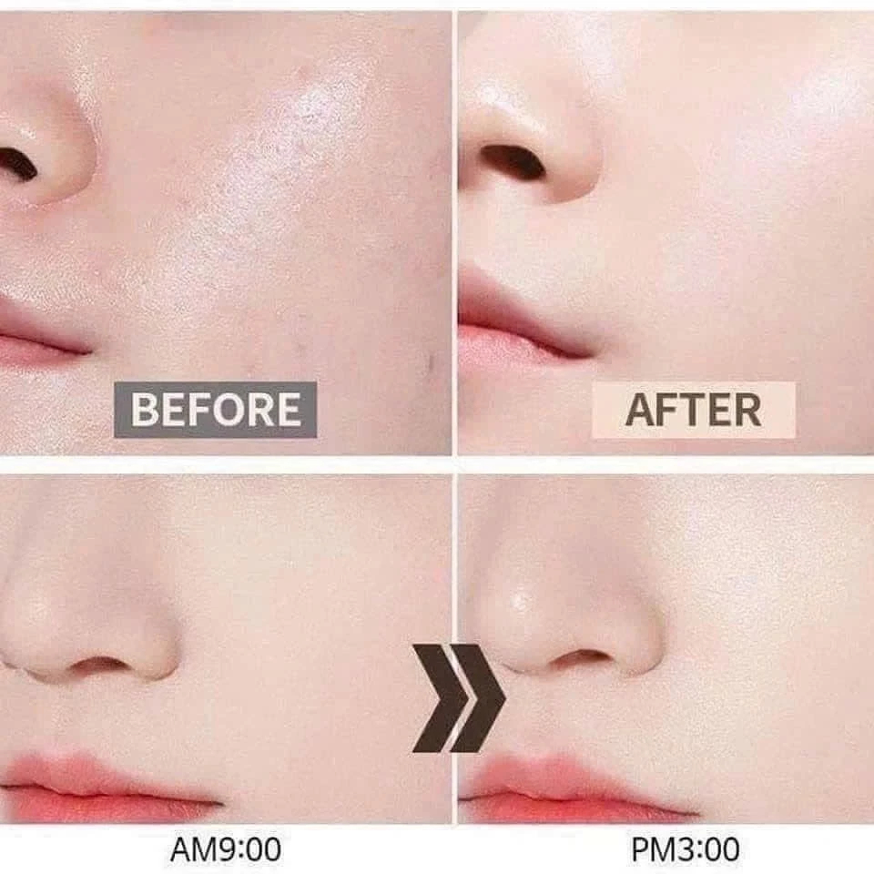 Serum dưỡng trắng da MEDI-PEEL Glutathione làm sáng làn da, phục hồi da bị cháy nắng, cấp ẩm tăng độ đàn hồi cho da 30ml
