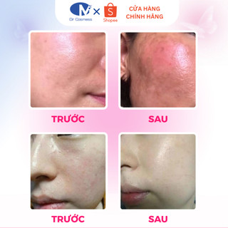 Kem Phục Hồi Da Revitalux Cream Dr. Cosmess, Phục Hồi Da Nám, Da Mỏng Yếu, Nhạy Cảm 50ml