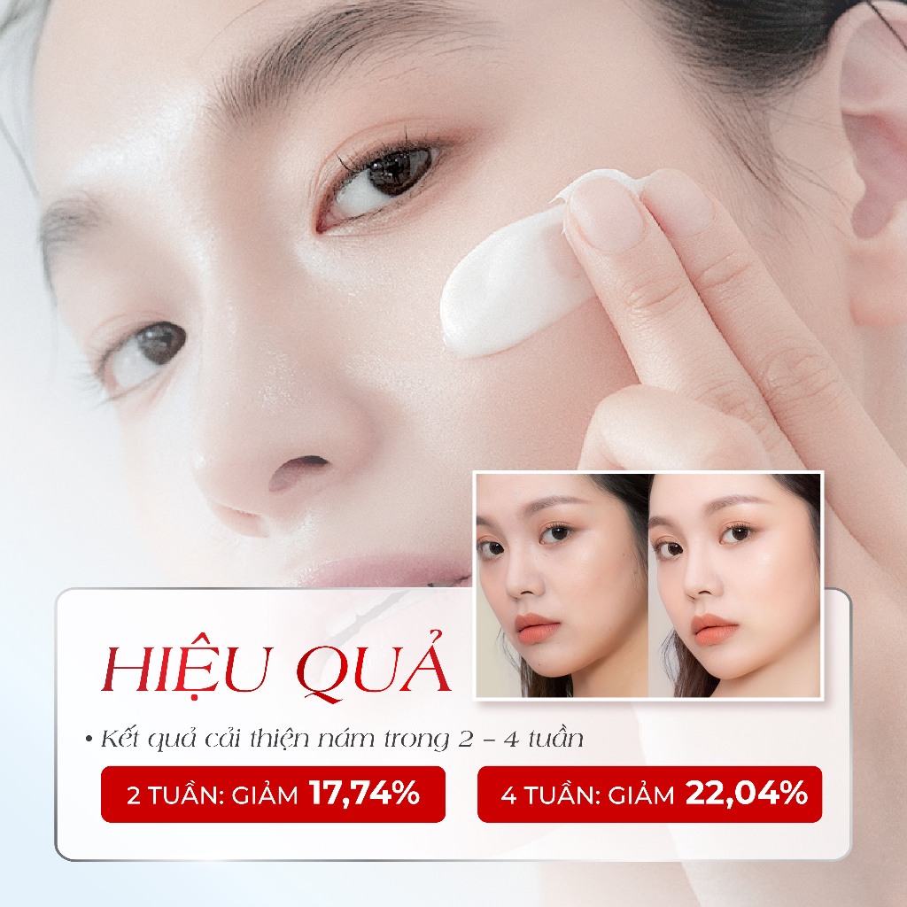 Combo mờ nám trắng da Melasma-X Kem Nám 3D & Kem Dưỡng Trắng 3D mờ thâm nám, chính hãng Hàn Quốc