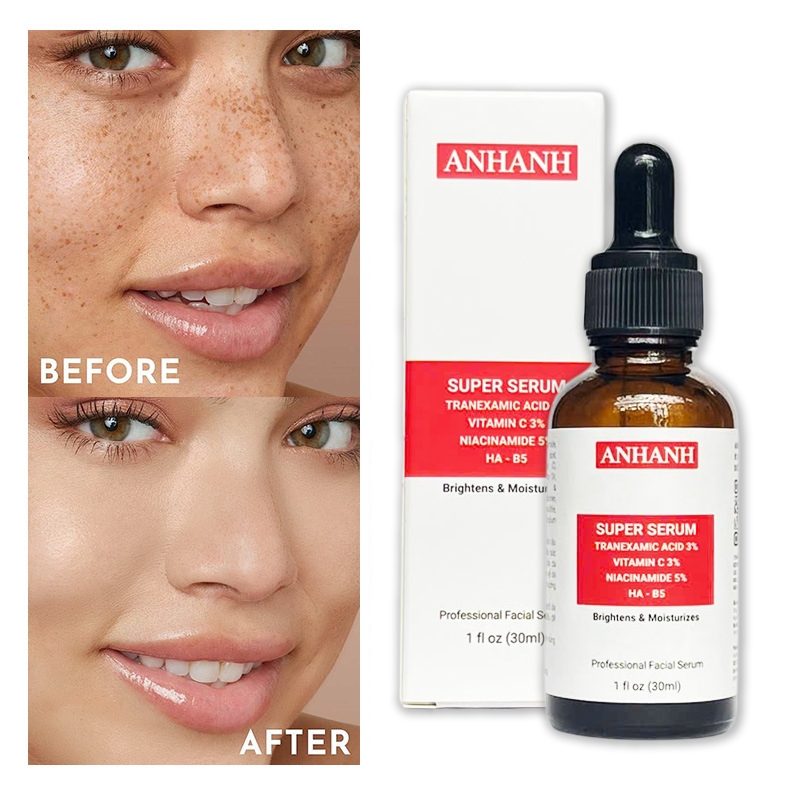 Super Serum dưỡng trắng da Vitamin C + Niacinamide B3 + Tranexamic Acid - ANHANH - Mờ thâm nám, sáng da, dưỡng ẩm
