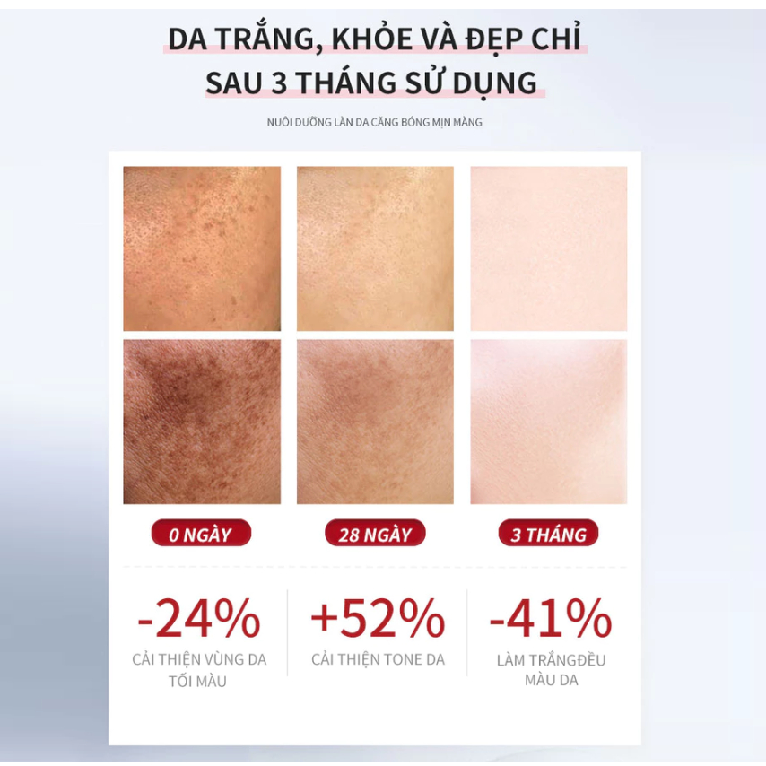 Super Serum dưỡng trắng da Vitamin C + Niacinamide B3 + Tranexamic Acid - ANHANH - Mờ thâm nám, sáng da, dưỡng ẩm
