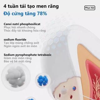 Kem đánh răng SP10 làm trắng răng, làm sạch mạnh mẽ loại bỏ vết ố vàng bảo vệ men răng vượt trội Kem đánh răng Probiotic