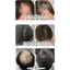 Serum Thảo Dược Quý Kích Thích Mọc Tóc - Herbal Hair Serum dạng Chai Lăn