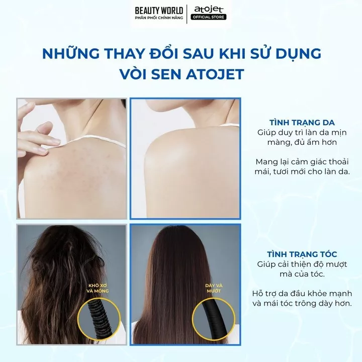 Bộ Vòi Sen Lọc Nước Atojet AJ-8200 Kèm 3 Lõi Lọc Đầu 3 Lõi Lọc Thân Tặng Sữa Tắm Arumore 500ml – 5