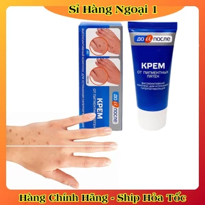 Kem Đồi Mồi Kpem Nga Hỗ trợ Mờ đồi mồi, Giúp trắng da, cấp ẩm cho da mịn màng