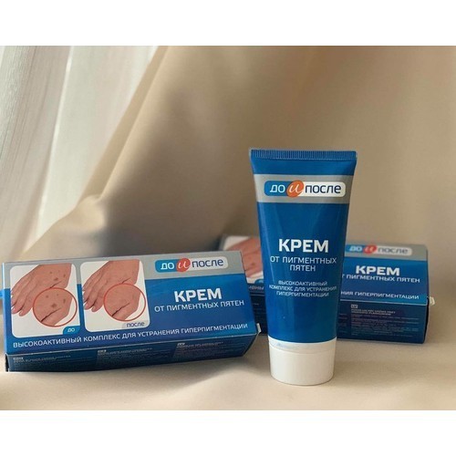 Kem Đồi Mồi Kpem Nga Hỗ trợ Mờ đồi mồi, Giúp trắng da, cấp ẩm cho da mịn màng