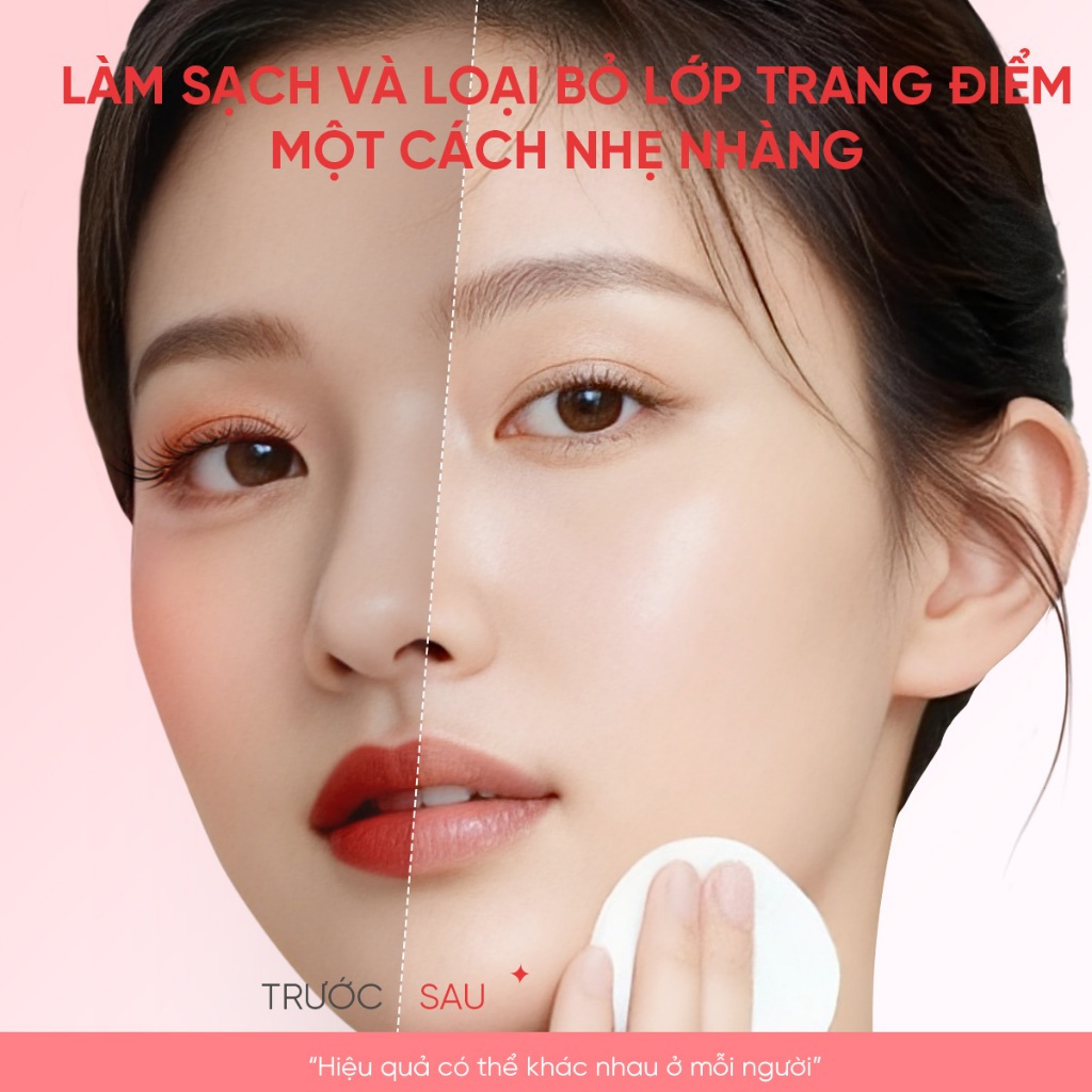 Nước tẩy trang The Originote tẩy trang dưỡng ẩm làm sạch sâu cho mọi loại da Hyalurose Micellar Water 300ml