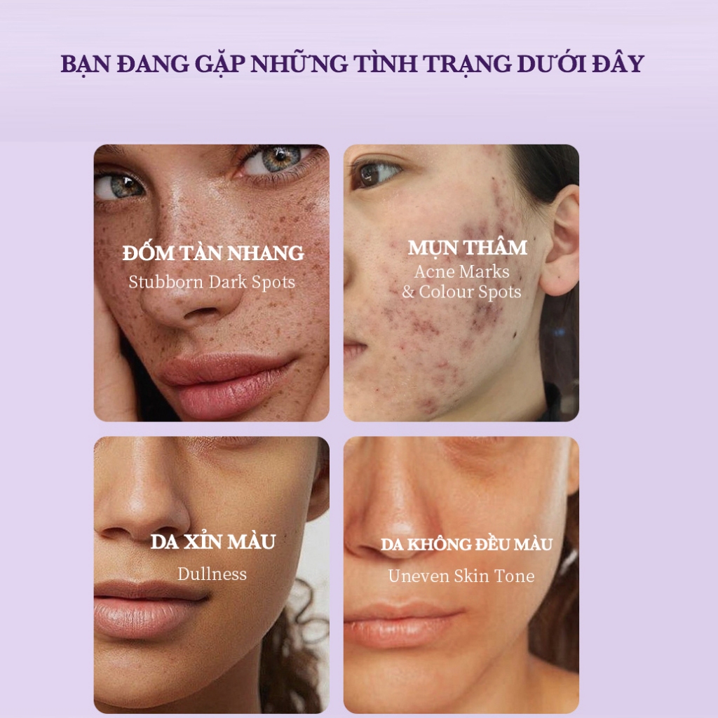 Super Serum dưỡng trắng da Vitamin C + Niacinamide B3 + Tranexamic Acid - ANHANH - Mờ thâm nám, sáng da, dưỡng ẩm