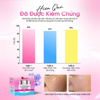 [LIVE] Kem Dưỡng Ẩm Collagen Kihasu Peptide 6in1 Giúp Da Căng Bóng, Trắng Sáng Tự Nhiên, Mờ Nám