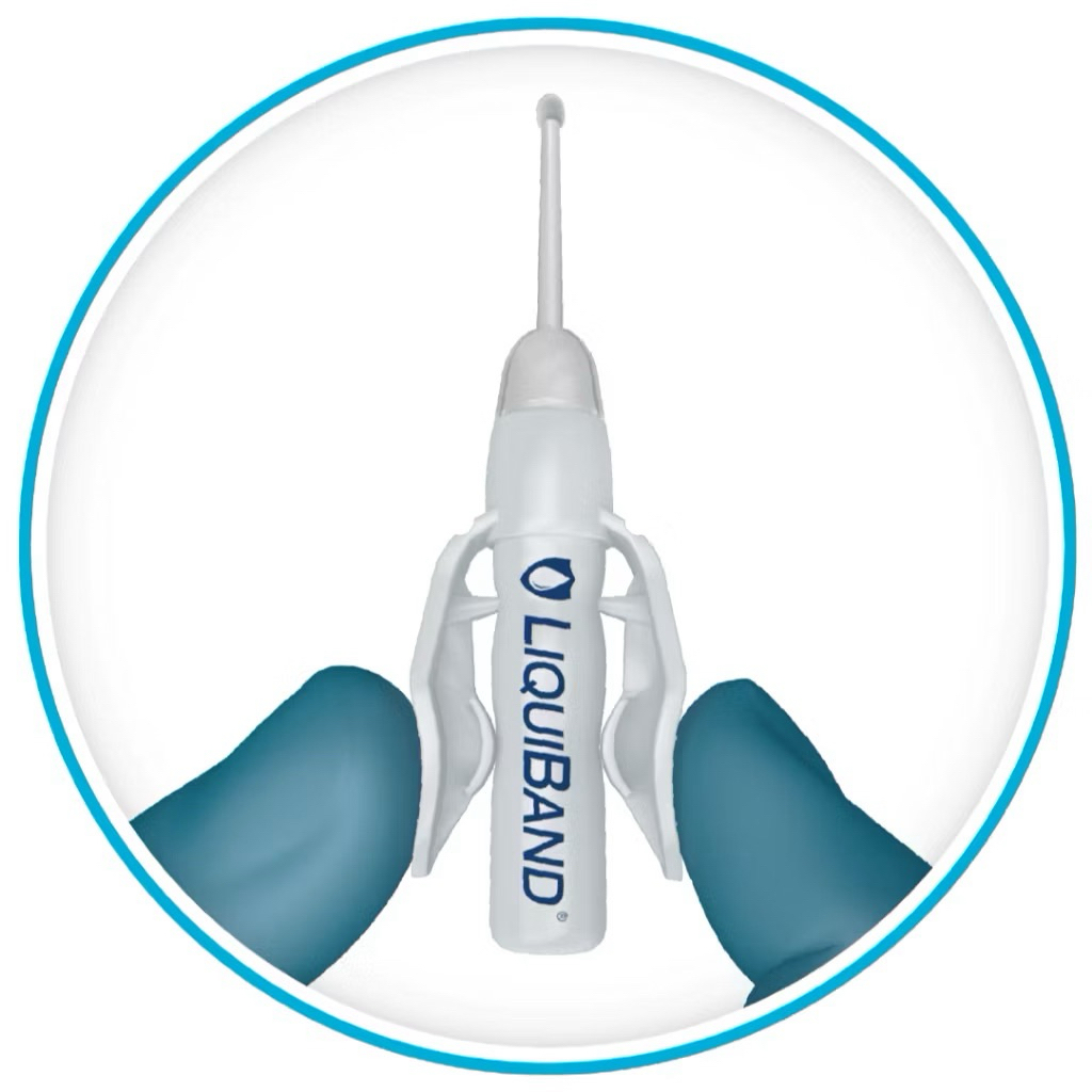 Keo đóng vết thương dạng gel LiquiBand Optima, thay chỉ khâu-thẩm mỹ- an toàn- nhanh lành