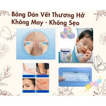 [Giao Hoả Tốc] Băng Dán Vết Thương Không Cần May – Miếng Dán Kéo Da Khép Vết Thương – Hạn Chế Sẹo