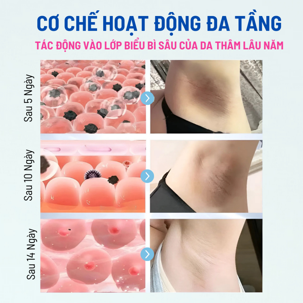 Kem Mờ Thâm Làm Hồng Vùng Nách, Mông, Đầu Gối, Khuỷu Tay – Giúp Dưỡng Trắng Làn Da Sạm Nhanh, Hiệu Quả ABS1