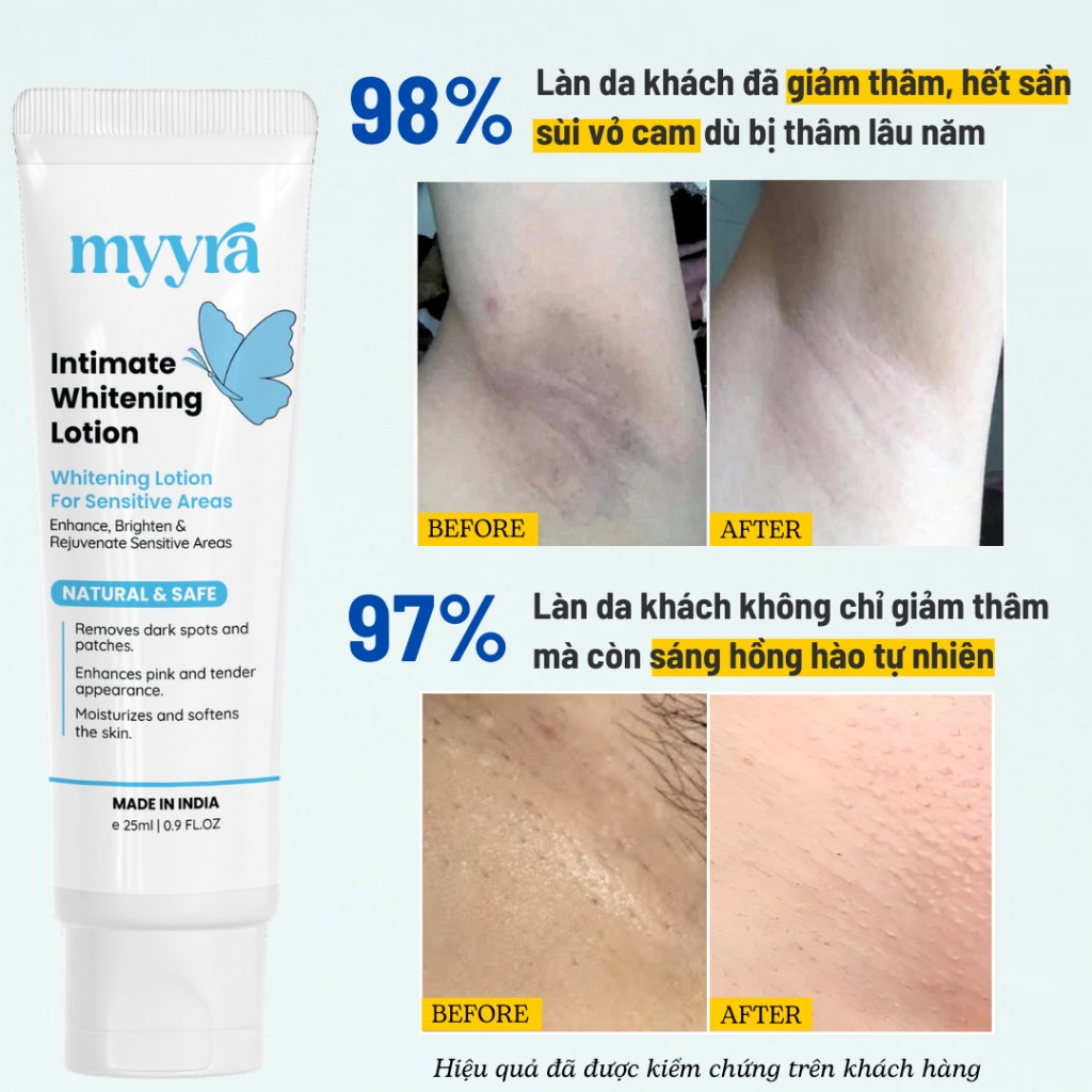 Kem Mờ Thâm Làm Hồng Vùng Nách, Mông, Đầu Gối, Khuỷu Tay – Giúp Dưỡng Trắng Làn Da Sạm Nhanh, Hiệu Quả ABS1