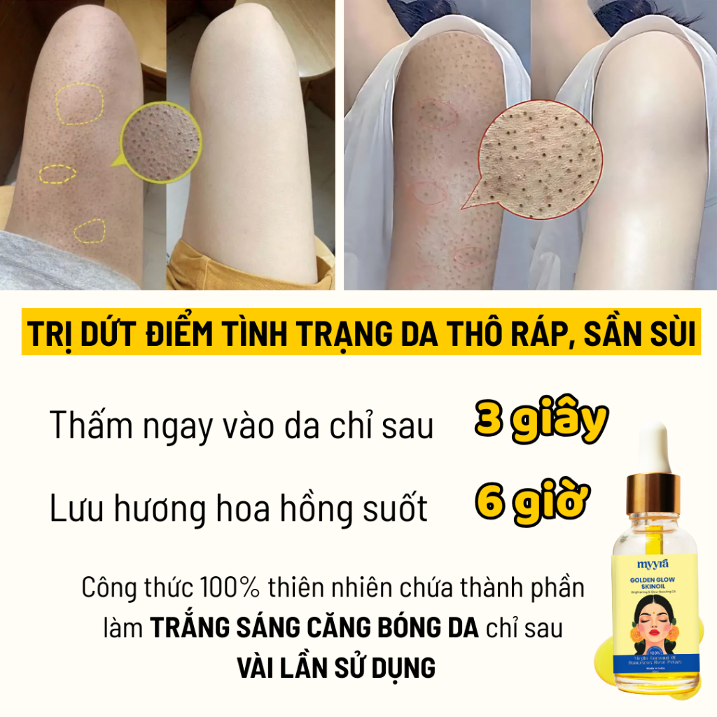 Dầu Dưỡng Trắng Mịn Da Toàn Thân Hương Hoa Hồng, Giúp Da Mềm Mịn, Giảm Thâm Dưỡng Sáng Hồng Da