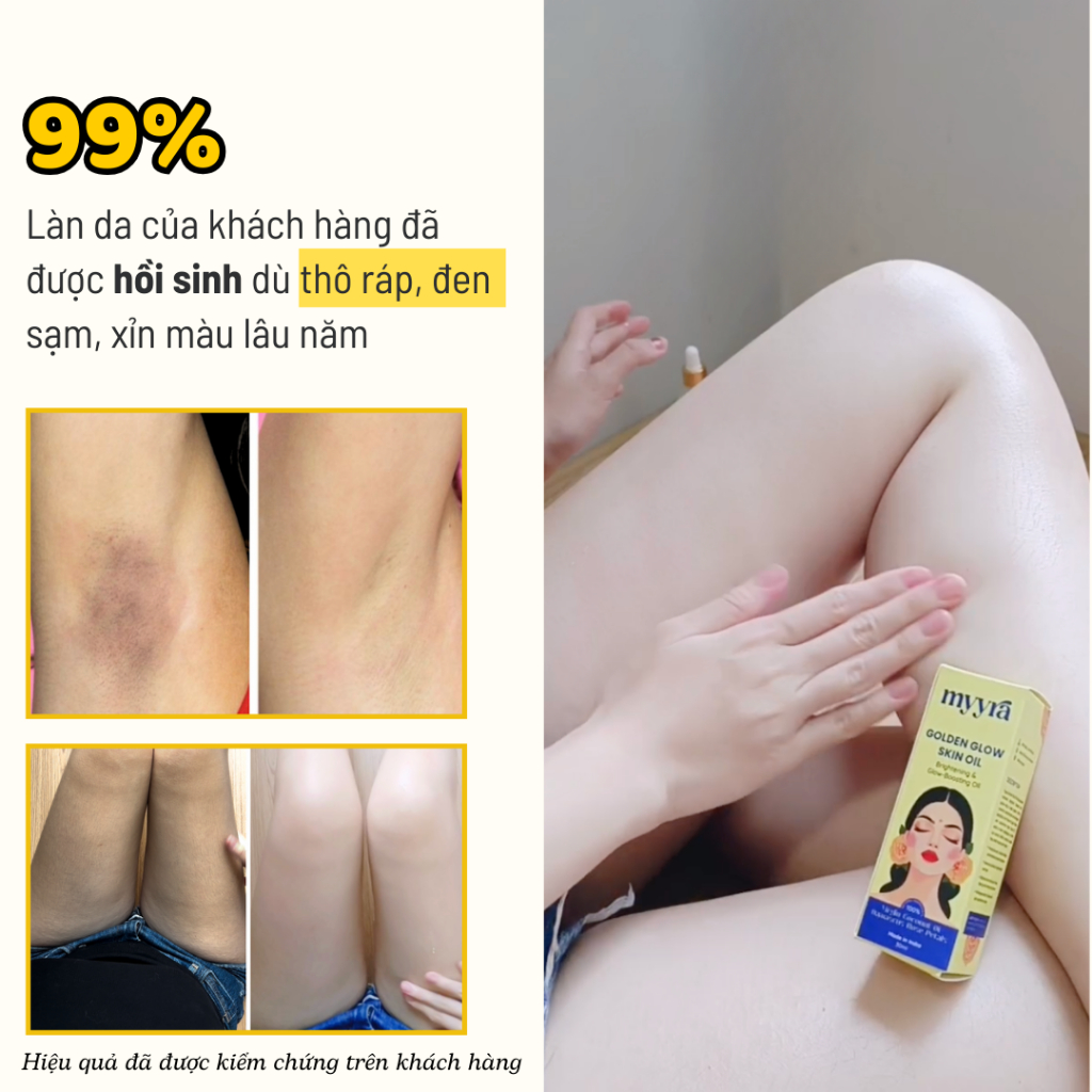 Dầu Dưỡng Trắng Mịn Da Toàn Thân Hương Hoa Hồng, Giúp Da Mềm Mịn, Giảm Thâm Dưỡng Sáng Hồng Da