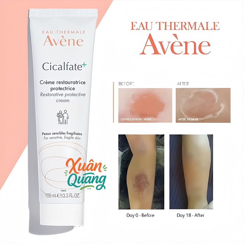 Kem phục hồi Eau Thermale Avene Cicalfate+ Restorative Protective Cream, giúp làm lành da, làm dịu tổn thương trên da