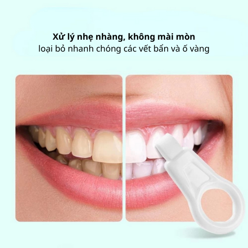 Bộ 3 Cái Làm Sạch Răng Trẻ Em Tẩy Mảng Bám, Nano Bọt Biển, Tế Bào Chết