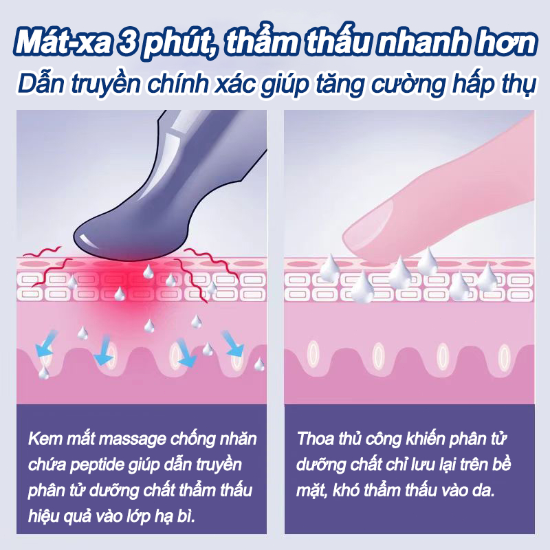 【Mua 1 Tặng 1】Kem dưỡng mắt Massage điện, kem dưỡng mắt, Kem Mắt Giảm Thâm Quầng - Trắng sáng da, giảm nếp nhăn