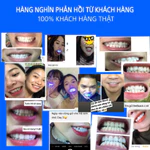 Máy Tẩy Trắng Răng Tại Nhà CONG FANSDR – Ánh Sáng Xanh + Gel Trắng Răng – Trắng Nhanh Không Ê Buốt – An Toàn- Trắng Lâu — ảnh 7