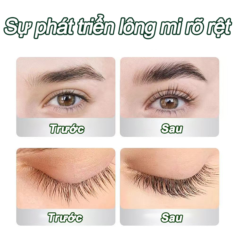 【MUA 1 TẶNG 1】tinh chất mọc dài mi, Serum dài mi, Serum Dưỡng Mi Dài, Kích Thích Mọc Mi Tự Nhiên, Dưỡng Lông Mi Và Lông