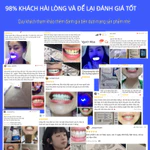 Máy Tẩy Trắng Răng Tại Nhà CONG FANSDR – Ánh Sáng Xanh + Gel Trắng Răng – Trắng Nhanh Không Ê Buốt – An Toàn- Trắng Lâu — ảnh 6