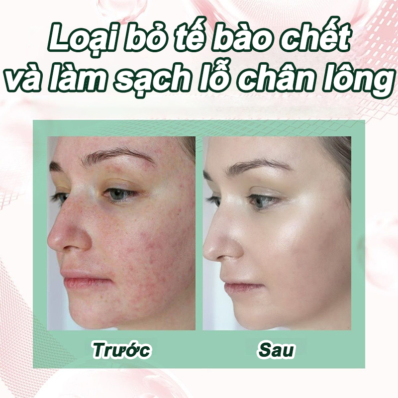 【MUA 1 TẶNG 1】Thanh lăn mặt nạ đất sét,que lăn mặt làm sạch lỗ chân lông, Thanh lăn mặt nạ đất sé, khít lỗ chân lông