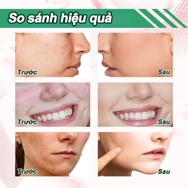 【MUA 1 TẶNG 1】Thanh lăn mặt nạ đất sét,que lăn mặt làm sạch lỗ chân lông, Thanh lăn mặt nạ đất sé, khít lỗ chân lông