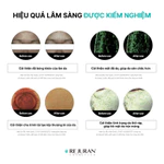 [CHỐNG LÃO HÓA] Tinh Chất DOT c-PDRN Hỗ Trợ Phục Hồi, Giúp Căng Bóng Cải Thiện Lão Hóa Sớm Rejuran Turnover Ampoule 30ml — ảnh 7