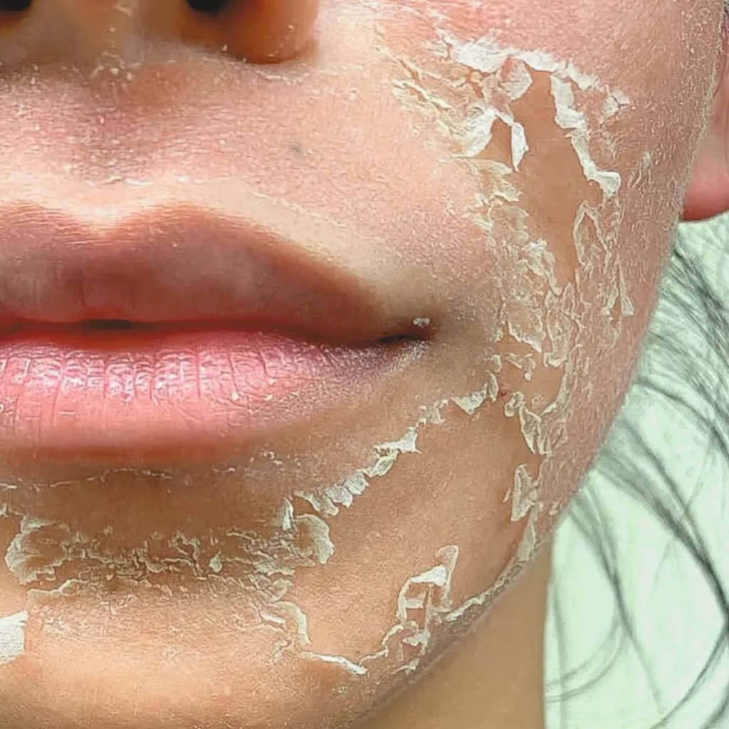 Vi kim tảo biển Rien'A Retox Riena