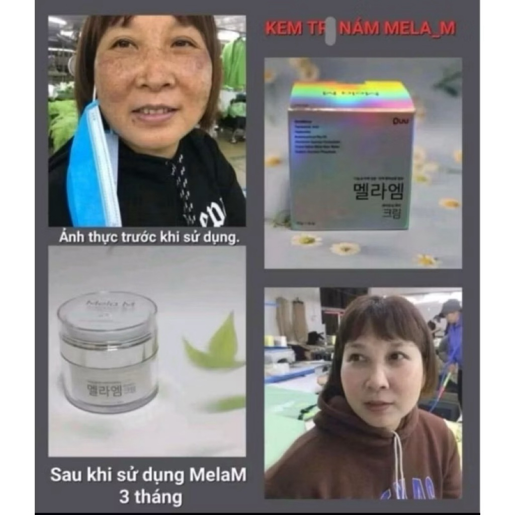 Kem nám Mela M Whitening Magic Cream,50g - hạn 2028 Hàn Quốc, trắng da, mờ nám thâm mụn tàn nhang  IS444