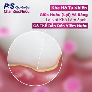 [PC gift] Combo 2 Kem đánh răng P/S Chuyên gia chăm sóc nướu Trắng răng 30g