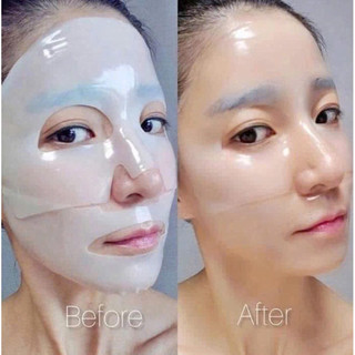 [hộp 5 nạ] Mặt Nạ Thạch Yool Đánh Thức Collagen Khơi Dậy Thanh Xuân Hỗ Trợ Làm Giảm Nám Tàn Nhang