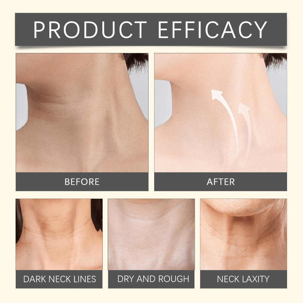 [HÀNG CHÍNH HÃNG] Kem dưỡng da vùng cổ MEDIPEEL sợi naite cao cấp chống lão hóa 100ml