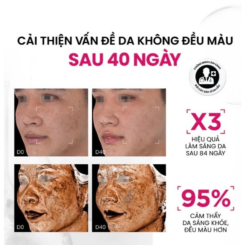 [CHÍNH HÃNG] Serum Sáng Da Đa Tầng Và Toàn Diện Thế Hệ Mới LALA Brightening Serum 30ml
