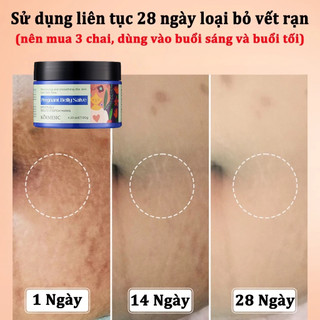 Kem Rạn Da cho bà bầu Loại bỏ sẹo sau khi mang thai Kem Chống Rạn Da 120g Giảm Rạn Hiệu Quả, Phục Hồi Da Nhanh Chóng