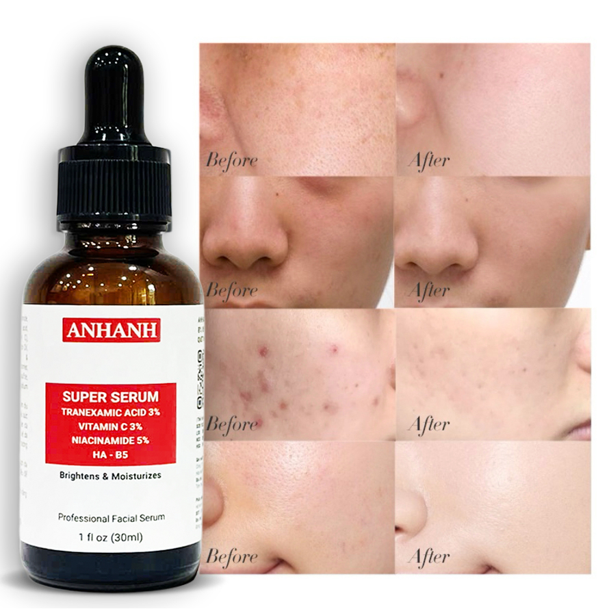 Super Serum Trắng da cho nam -  ANHANH - làm sáng da, mờ thâm dưỡng ẩm, làm săn chắc da mặt