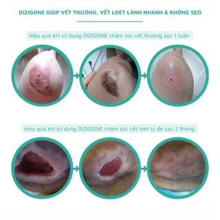 Dung dịch Dizigone loại bỏ vi khuẩn (1 chai x 300ml)