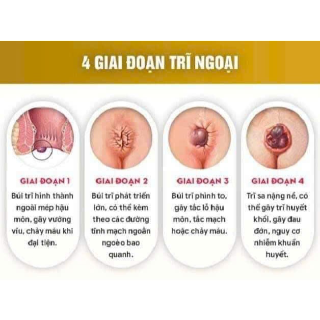 Cao bôi giúp giảm đau rát, trĩ nội trĩ ngoại khi đi vệ sinh của dân tộc Tày