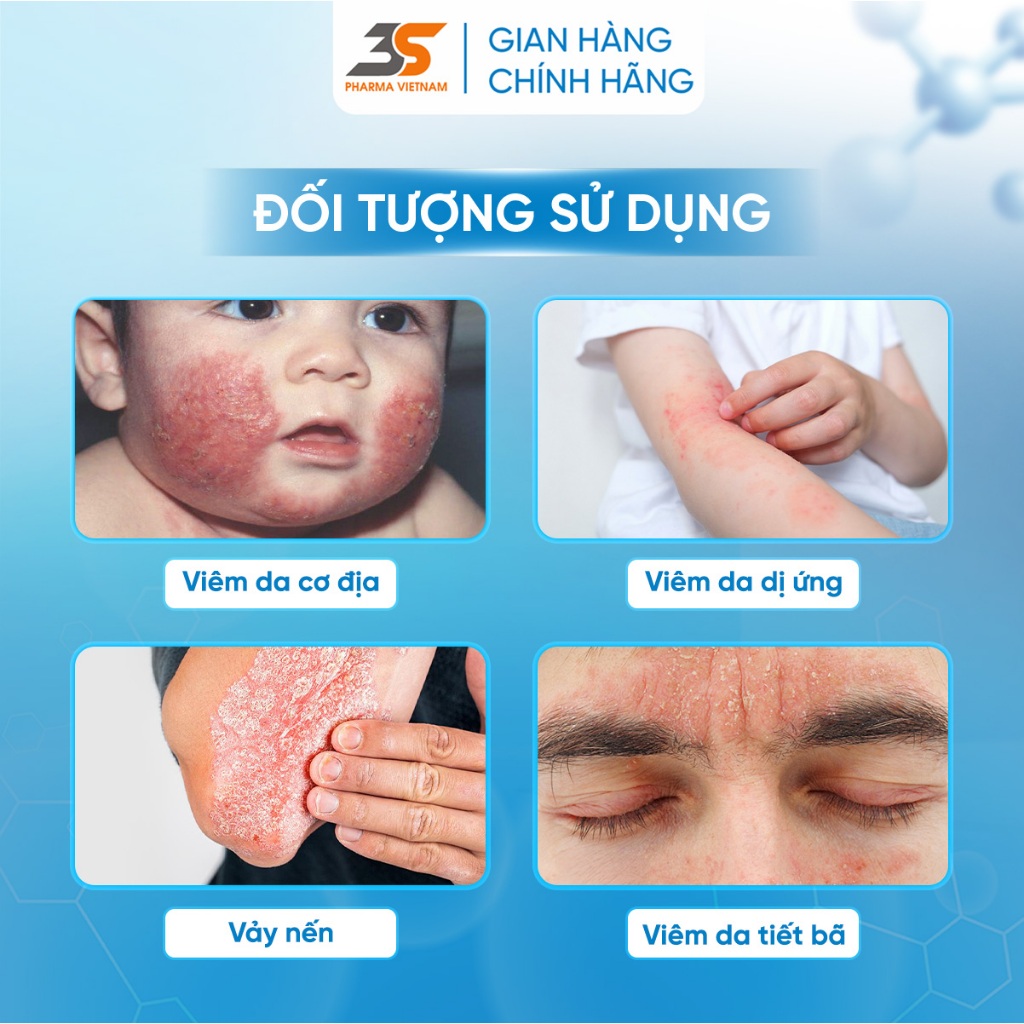 Blue Cap Foam dạng bọt cho vảy nến, viêm da cơ địa, viêm da tiết bã, viêm da dị ứng - Chai 100ml