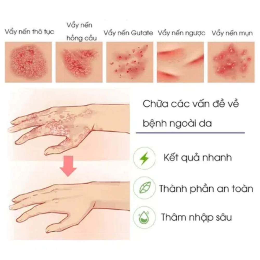 Thiết kế của Tuýp Kem Bôi