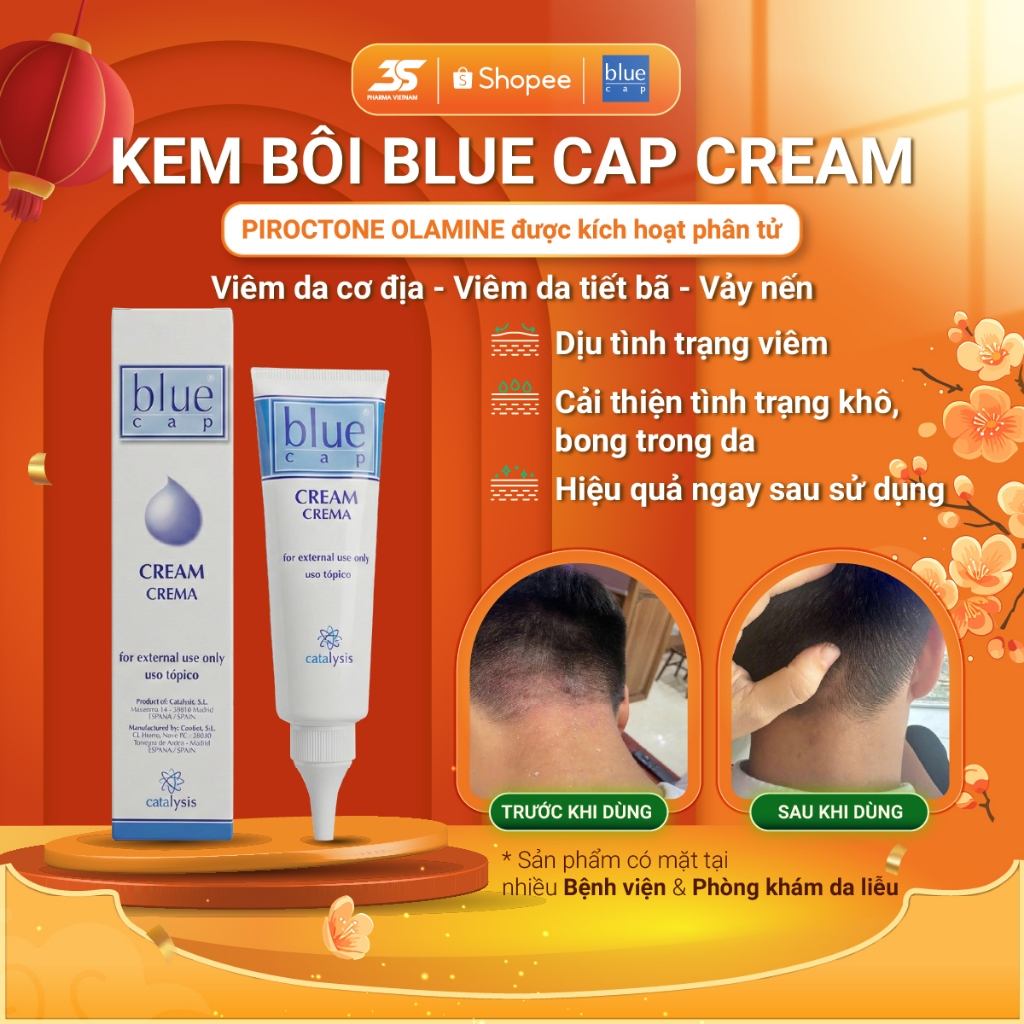 Kem bôi Blue Cap Cream cho Viêm Da Cơ Địa, Viêm Da Tiết Bã, Viêm Da Dị Ứng, Vảy Nến - Tuýp 50g