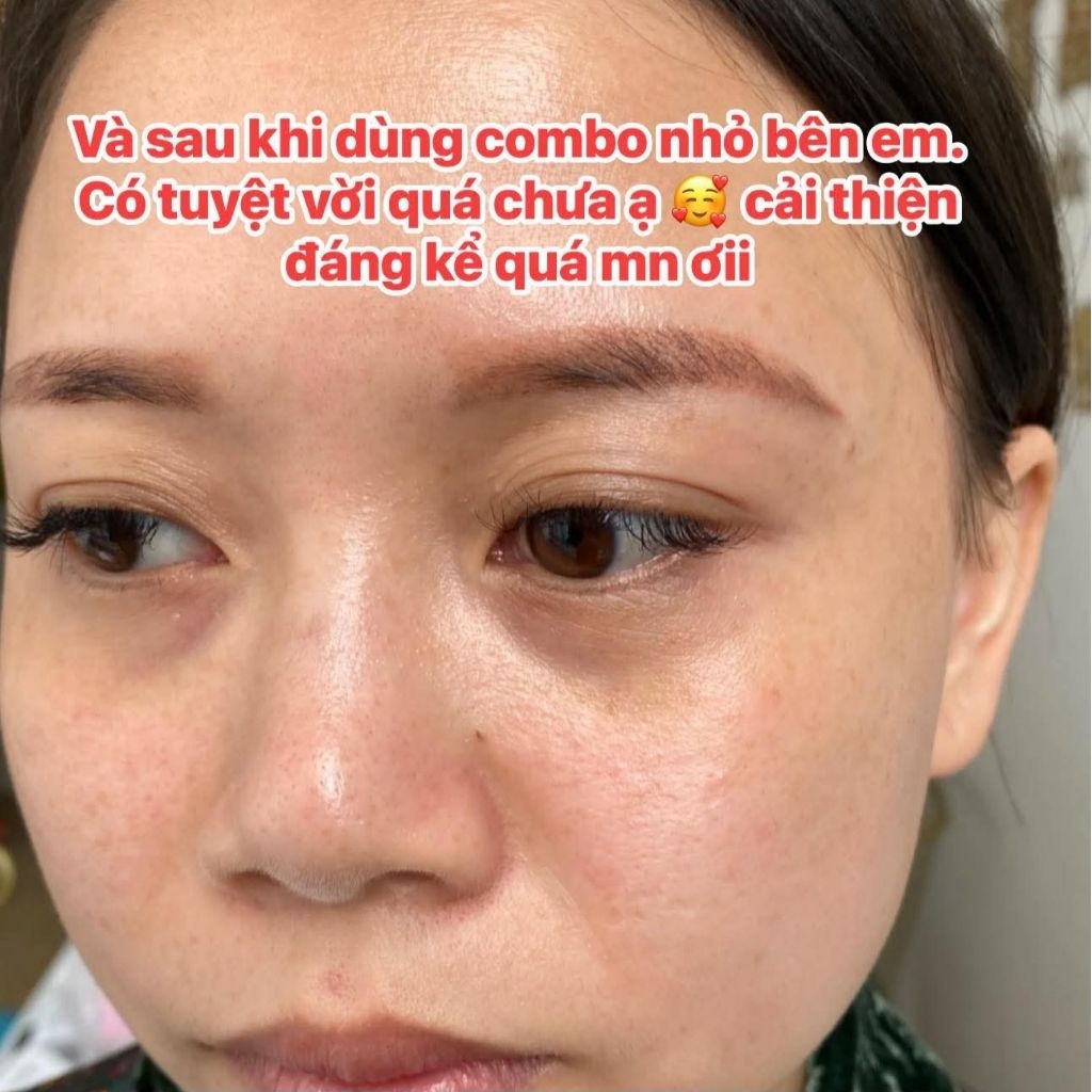 Kem Nám Mờ Thâm Eugénie Dưỡng Trắng Mờ Đều Màu Da Bộ 3 Món