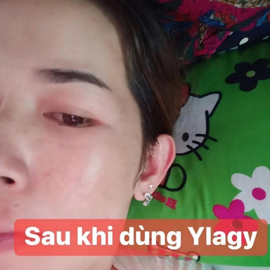 Serum Cấp Ẩm Ylagy Extra Repair Dưỡng Sáng Da Phục Hồi Da Khô Xỉn,