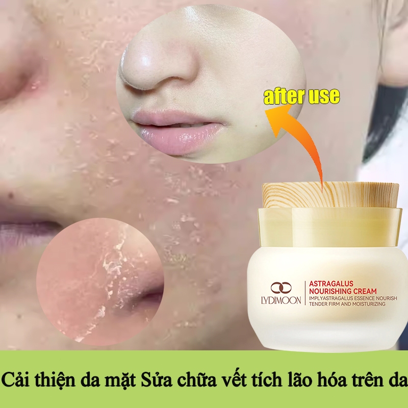Astragalus Kem Dưỡng Chống lão hóa cải thiện khô xỉn màu đỏ làm sáng màu da và làm săn chắc da 50g