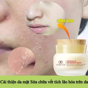 Astragalus Kem Dưỡng Chống lão hóa cải thiện khô xỉn màu đỏ làm sáng màu da và làm săn chắc da 50g
