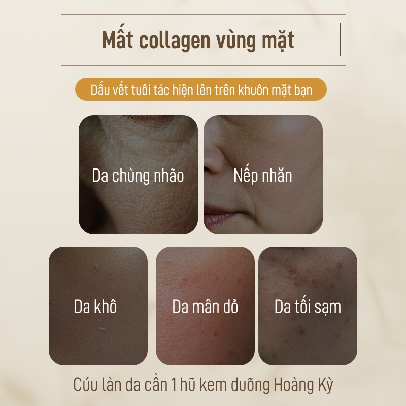 Astragalus Kem Dưỡng Chống lão hóa cải thiện khô xỉn màu đỏ làm sáng màu da và làm săn chắc da 50g