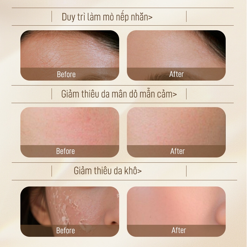 Astragalus Kem Dưỡng Chống lão hóa cải thiện khô xỉn màu đỏ làm sáng màu da và làm săn chắc da 50g