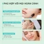 Miếng Dán Mụn Trứng Cá, Thiết Kế Đầy Màu Sắc, Chất Liệu Hydrocolloid, Nhãn Dán Hỗ Trợ Làm Sạch Nhân Mụn