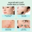 Miếng Dán Mụn Trứng Cá, Thiết Kế Đầy Màu Sắc, Chất Liệu Hydrocolloid, Nhãn Dán Hỗ Trợ Làm Sạch Nhân Mụn