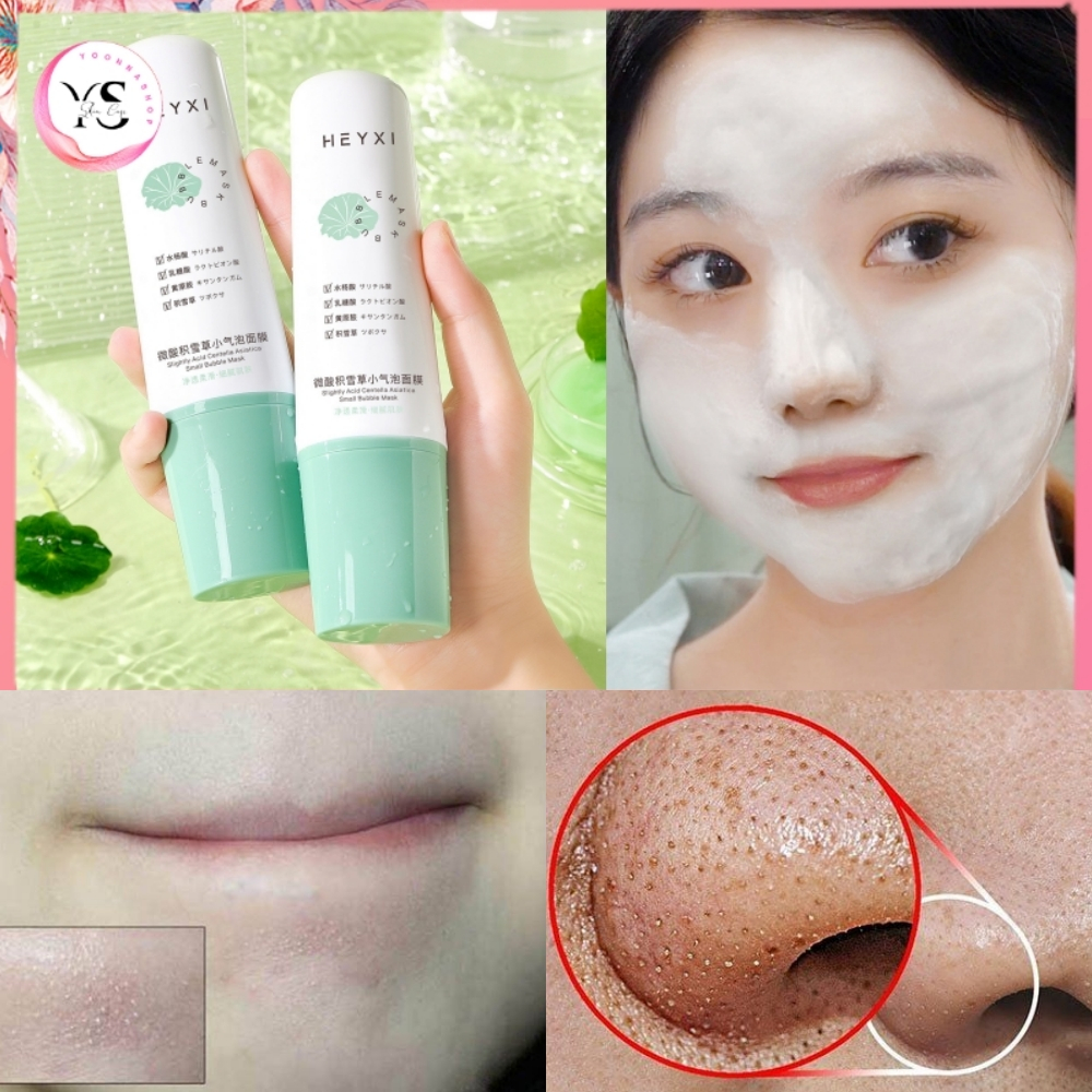 Mặt nạ sủi bọt rau má HEYXI 100g – Hỗ Trợ Giảm Mụn, Kiểm Soát Dầu– Cực ...